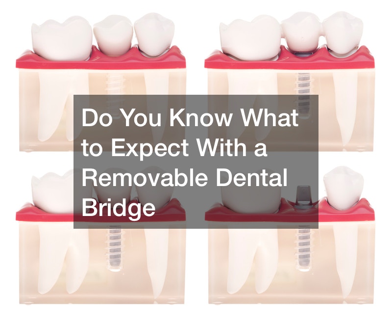 Do You Know What to Expect With a Removable Dental Bridge