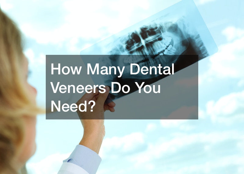 How Many Dental Veneers Do You Need?